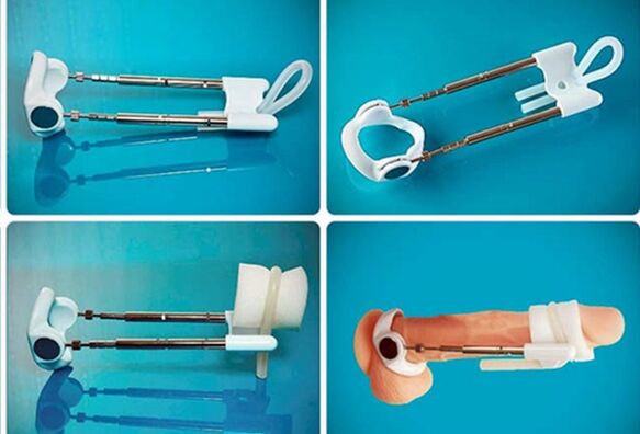 extender para sa pampalapot ng ari